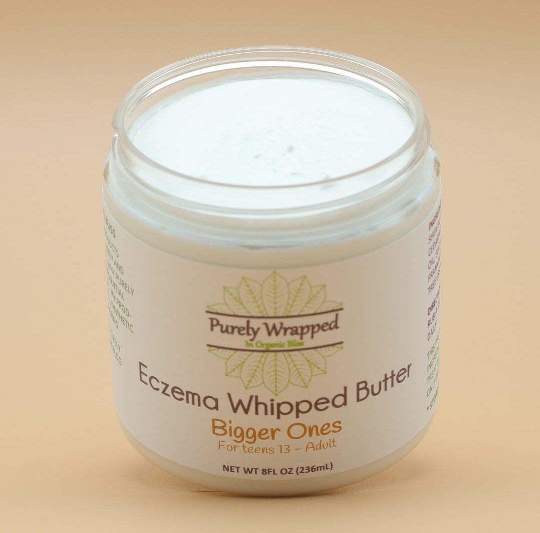 Eczema Whipped Body Butter Bigger Ones - Open Jar